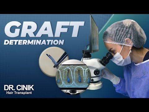 Graft Determination | Hair Transplant | Dr. Emrah Cinik