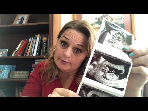 46 & PREGNANT w BABY #13/WEEK 15/ STRESS ME OUT....???!!! Video