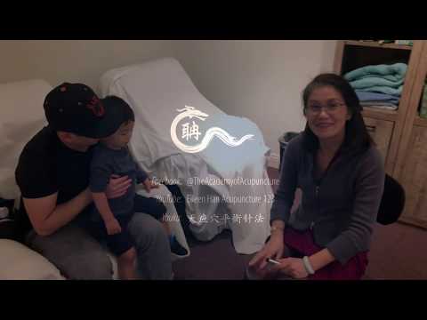 Pediatric Acupuncture-Cold and Digestion issues - #eileenhan #譚針 #pachipachi
