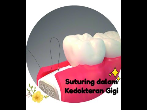 Praktikum Preklinik III 2020 : Flap dan Suturing (Ida Ayu Putu Indah Riana/17-13)