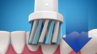 Introducing Oral-B PRO 1000