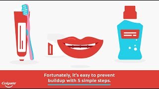 How to Remove and Prevent Plaque on Teeth | Colgate®