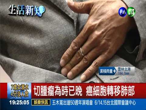 誤以為拉肚子就醫 男罹患胰臟癌