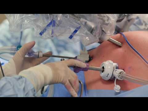 NHS Southmead Hospital - DaVinci Robot