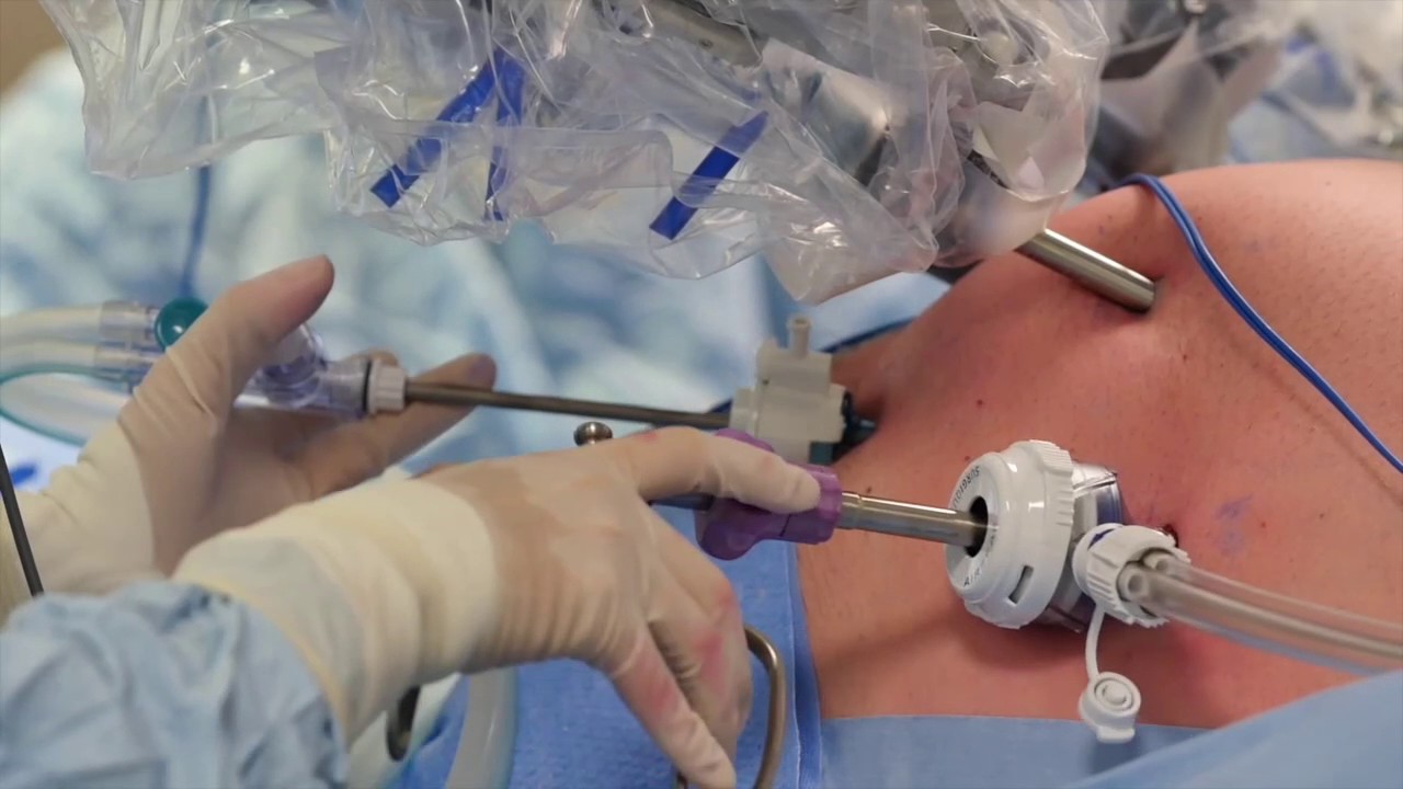 Corporate video production - Da Vinci Robot Fundraising Film