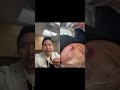 #shorts Abscess vs Inflamed Cyst??