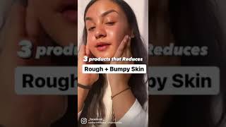 3 must have to treat bumpy skin