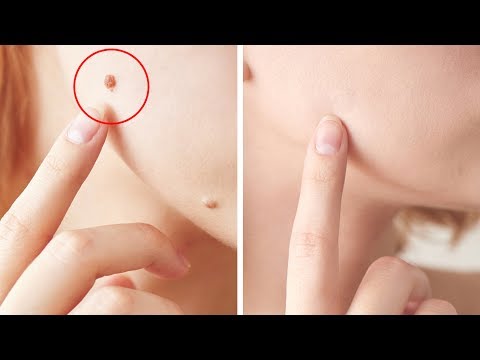 Istituto di bellezza di una lentiggine Affronti pacchi e la decolorazione del corpo