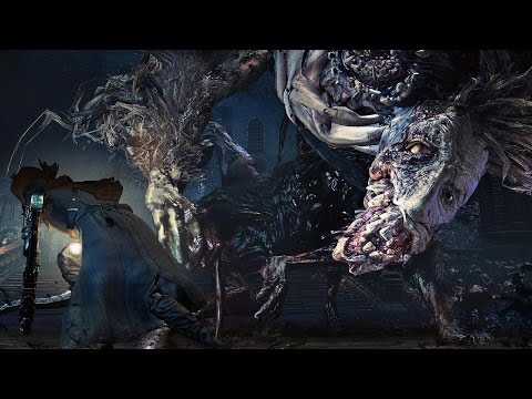 download lagu mp3 mp4 Ludwig Bloodborne, download lagu Ludwig Bloodborne gratis, unduh video klip Ludwig Bloodborne