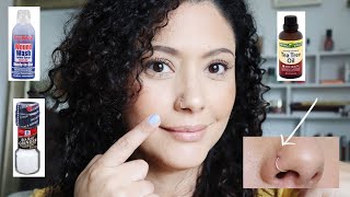 How to get rid of Nose piercing bump/ Home remedy