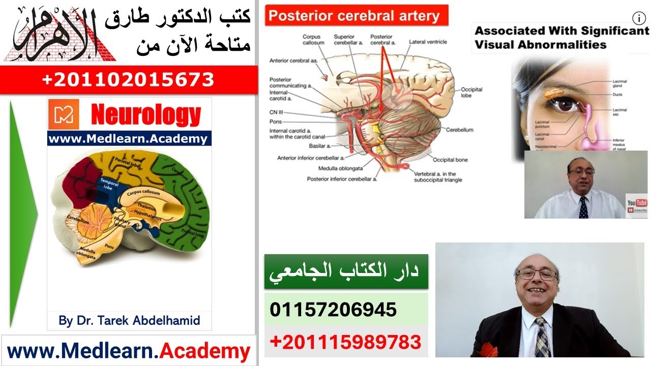 Stroke (II)- B Localization of the level of the lesion