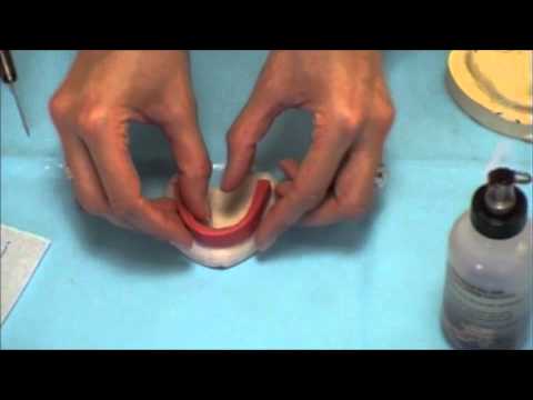 comment regler l'occlusion en prothese complete
