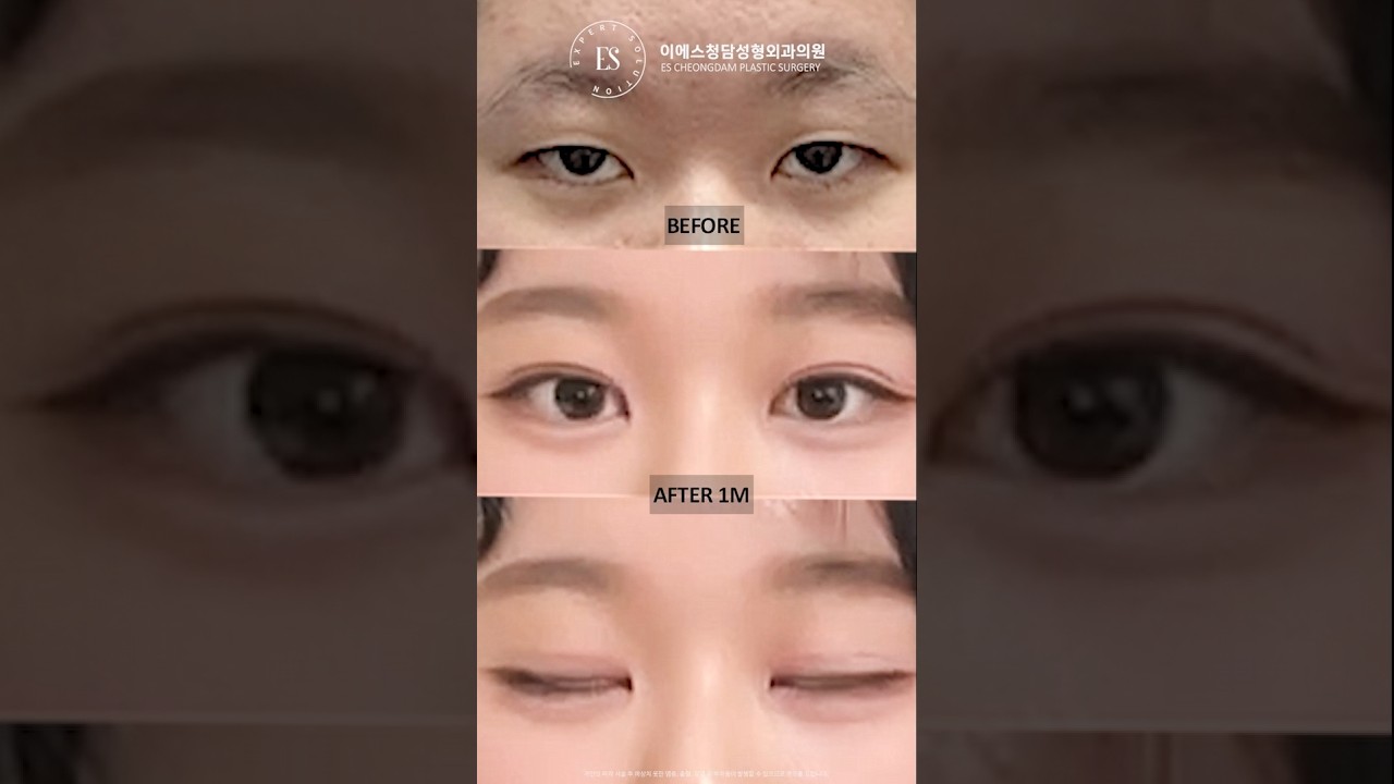 이에스 유튜브