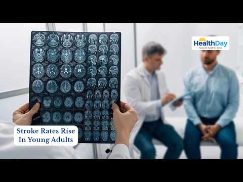 Stroke Rates Nearly Double in Younger Adults