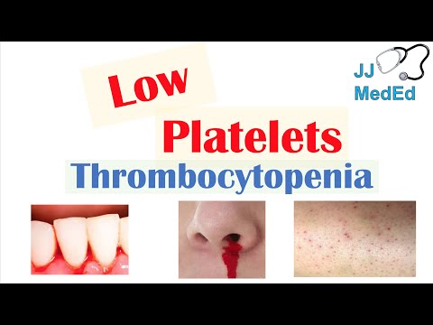 Thrombocytopenia | Signs and Symptoms and Approach to Causes