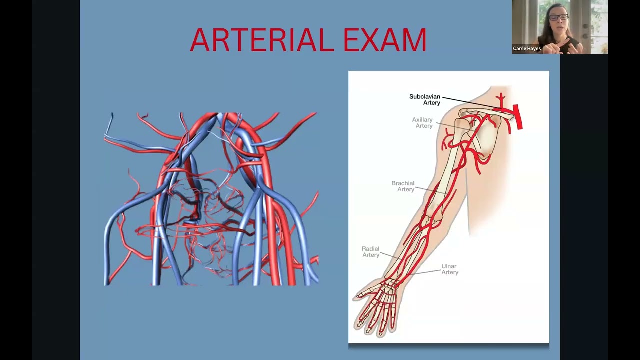 Vascular Imaging Webinar Series: Arteriovenous Mapping for Dialysis Access