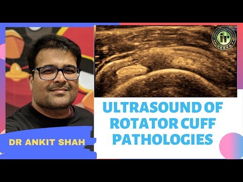TMT: USG in Rotator Cuff Pathologies by Dr Ankit Shah