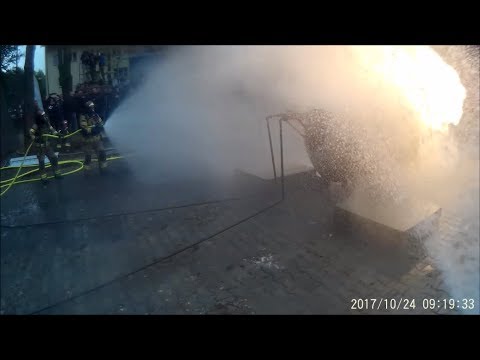 Guzek w palcu drzewie Leczenie koślawego deformacji u dzieci ćwiczenia