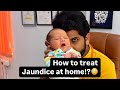 How To Treat Newborn Jaundice Newborn Jaundice Treatment
