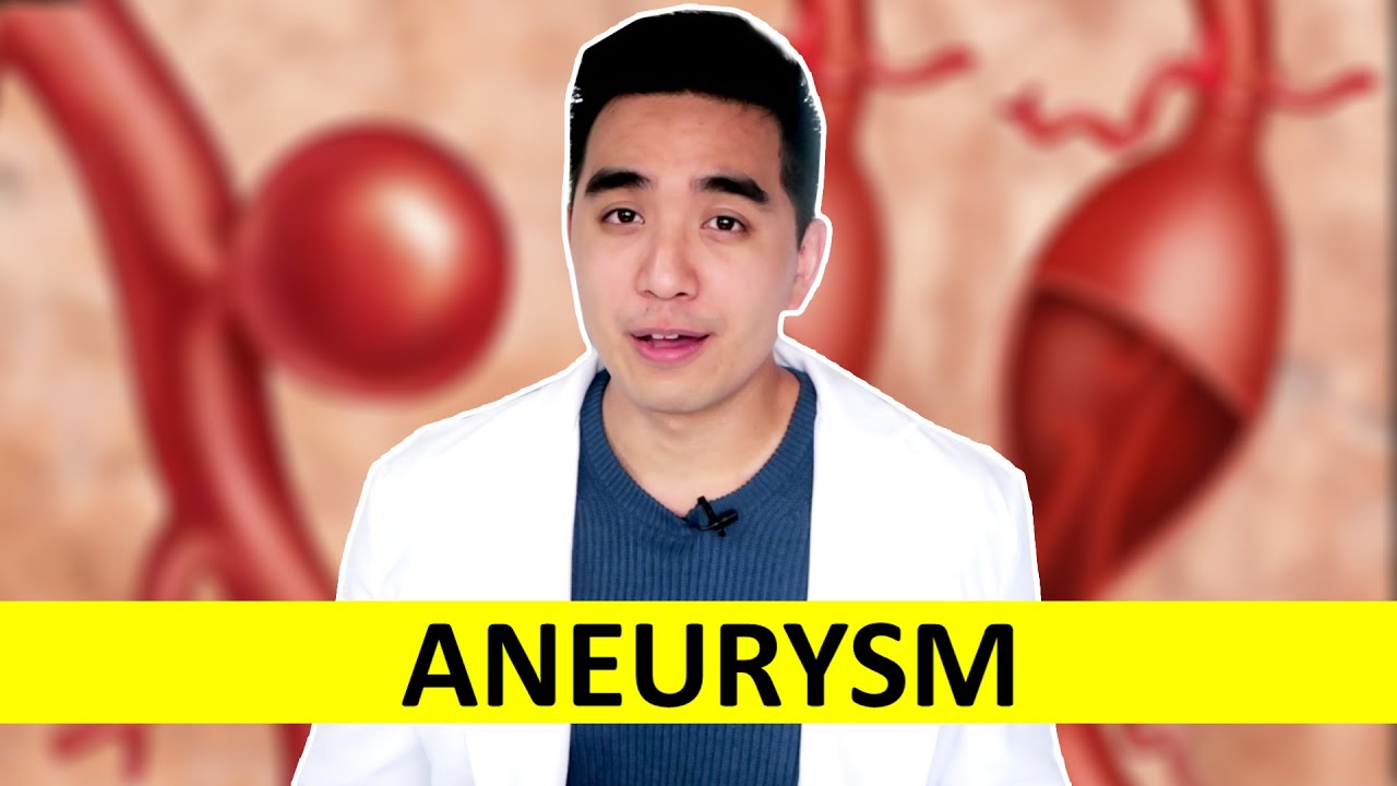 Putar video ANEURYSM - Paano ito iwasan May gamot ba Tumutubo ba sa isang araw sekarang ANEURYSM - Paano ito iwasan May gamot ba Tumutubo ba sa isang araw