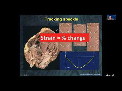 Imaging, cardiovascular programme and heart failure | Pulse 2021