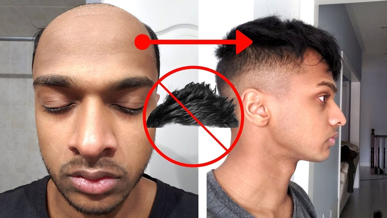 The Bad Things About Wearing A Mens Hair System