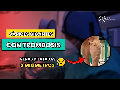 Manolo Briceño Alvarado-18