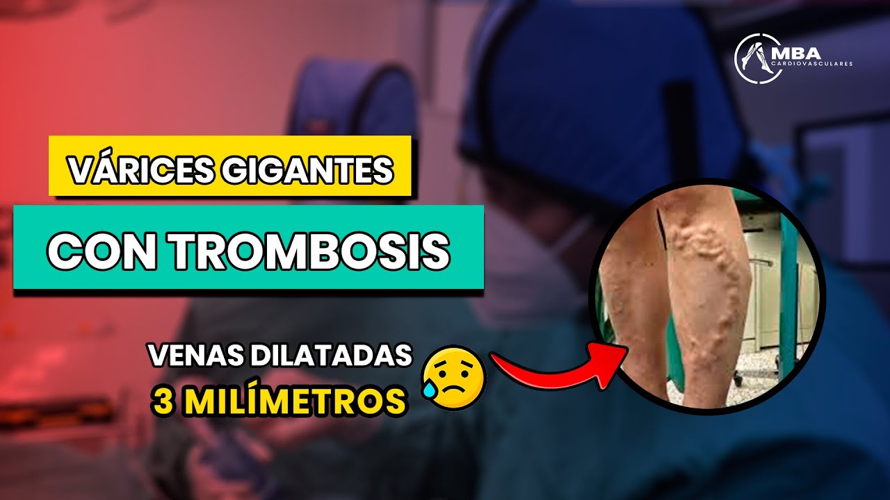 Manolo Briceño Alvarado-18