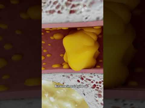 How to Remove Ear Wax Blockage the Right Way #shorts #facts - creativelearning3d