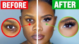How To COVER Dark Under Eye Circles