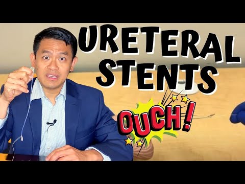 URETERAL STENTS FOR KIDNEY STONE SURGERY | How to remove ureteral stents at home