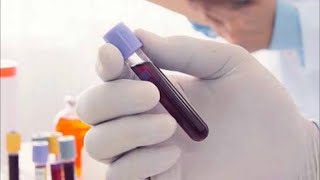 Exame de PCR elevado requer tratamento imediato | Dr Dayan Siebra