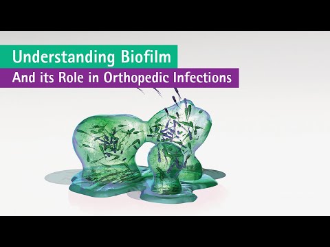 Understanding Biofilms in Orthopedic Infections (Part 1)