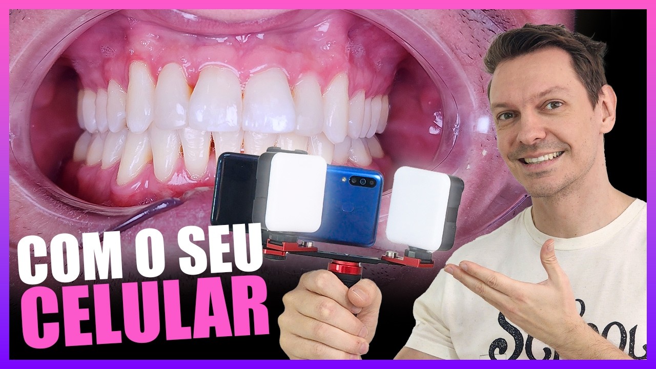FOTOGRAFIA ODONTOLÓGICA COM O CELULAR