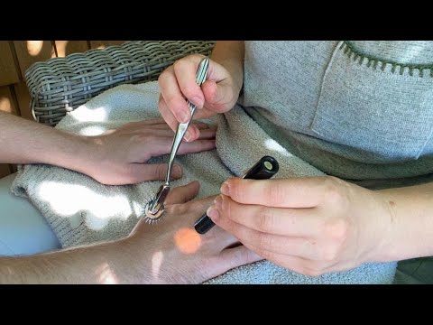 [ASMR OUTSIDE] Medical Hand Exam on a Real Person | Sharp or Dull, Measuring, Light Exam, Sensory
