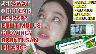 Download lagu Review Jujur 1 Bulan Pemakaian Pasta Gigi Herbal H... mp3
