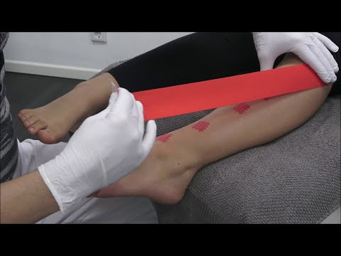 Podo Taping Concept© - das Fußheber Tape -