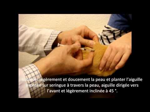 comment prendre ovitrelle