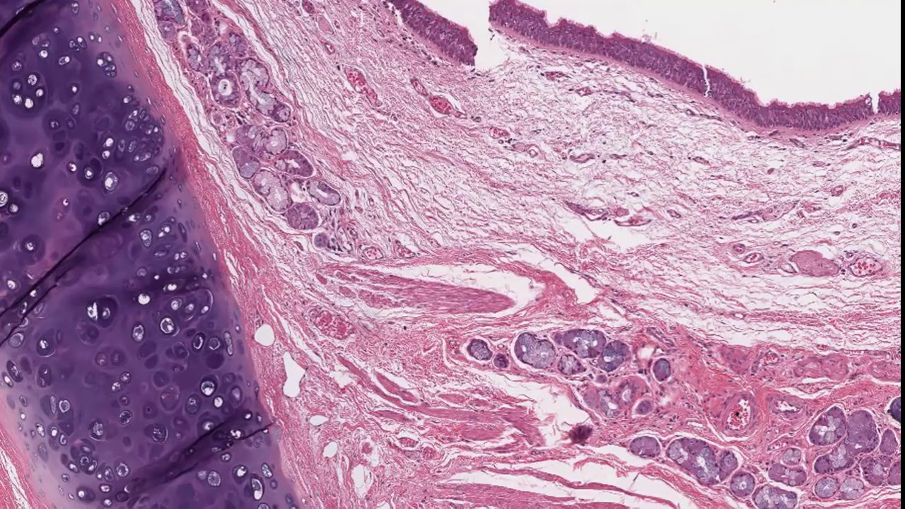 Histología del hígado