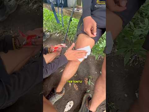 Cara kerja tissu ajaib #faktamenarik