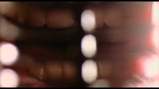 Local H - Fritz's Corner (HD Music Video)