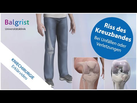 Cruciate ligament rupture: surgical treatment of anterior cruciate ligament rupture