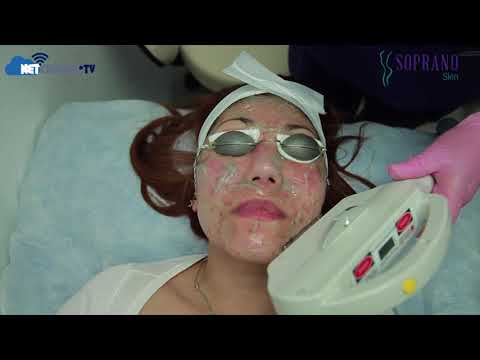 COMO QUITAR LAS MANCHAS DE ACNE