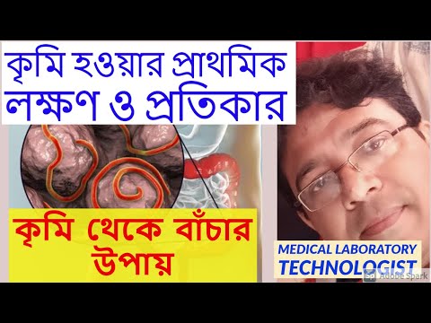 কৃমি হওয়ার প্রথমিক লক্ষণ ও প্রতিকার  Common sign of Intestinal worms and remedies.