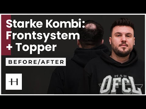 Haartransformation im Doppelpack mit Timo: Topper & Frontsystem