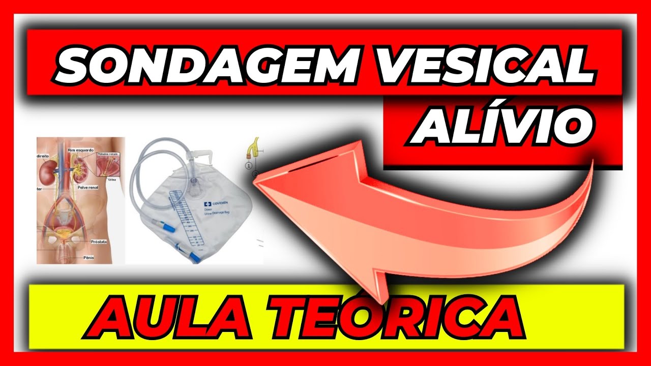 ✅ Sonda vesical de alívio ou intermitente - Aula completa