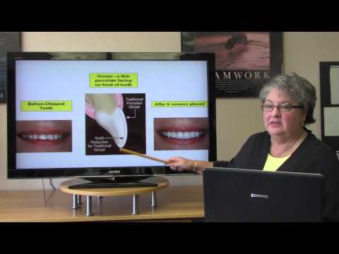 Common Dental Procedures