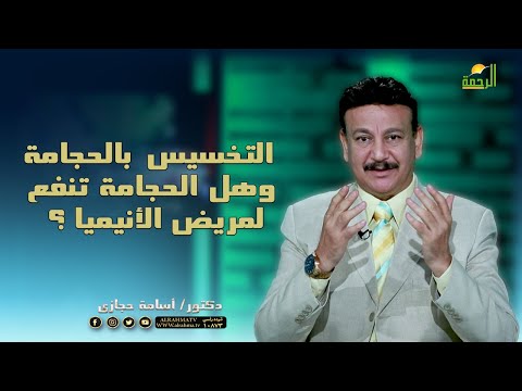 التخسيس بالحجامة وهل الحجامة تنفع لمريض الأنيميا ؟ || ناقص واحد || دكتور أسامة حجازي