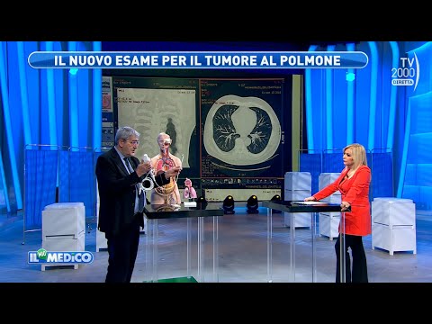 Il Mio Medico (Tv2000) - Prevenzione del tumore al polmone e nuovi esami di screening
