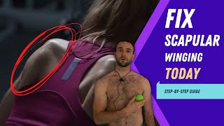 How I Fix Scapular Winging with Shoulder Internal Rotation
